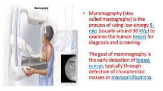 • Mammography (also
called mastography) is the
process of using low-energy X-
rays (usually around 30 kVp) to
examine the human breast for
diagnosis and screening.
The goal of mammography is
the early detection of breast
cancer, typically through
detection of characteristic
masses or microcalcifications.
 