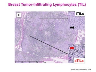 Immunotherapy for Metastatic Triple Negative Breast Cancer | PDF