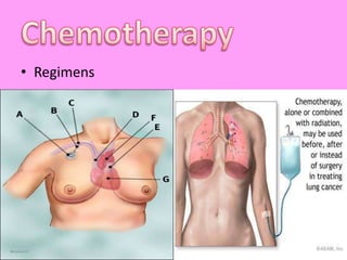 ChemotherapyRegimens