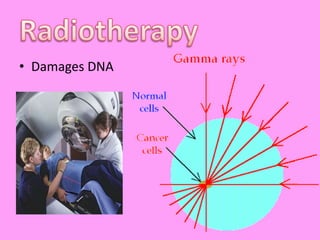 RadiotherapyDamages DNA