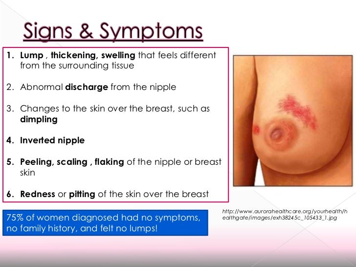 Lipoma Fatty Tumor Growth Causes Soft Under Skin Lumps ...