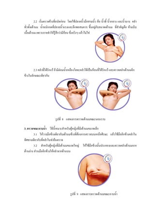 2.2 เริ่มตรวจขางที่ถนัดกอน โดยใชปลายนิวมือสามนิ้ว คือ นิวชี้ นิ้วกลาง และนิ้วนาง คลํา
                                                        ้             ้
ทั่วทั้งเตานม น้ําหนักกดทีปลายนิ้วแรงและลึกพอสมควร ขึ้นอยูกับขนาดเตานม ที่สําคัญคือ หามบีบ
                            ่                                  
เนื้อเตานม เพราะอาจทําใหรูสึกวามีกอน ซึ่งจริงๆ แลวไมใช




        2.3 คลําที่ใตรักแร ถามีตอมน้ําเหลืองโตจะคลําไดเปนกอนที่ใตรักแร และตรวจคลําเตานมอีก
ขางในลักษณะเดียวกัน




                            รูปที่ 8 แสดงการตรวจเตานมขณะนอนราบ

3. ตรวจขณะอาบน้ํา วิธีนี้เหมาะสําหรับผูหญิงที่มีเตานมขนาดเล็ก
         3.1 ใหวางมือขางเดียวกับเตานมขางที่ตองการตรวจบนเหนือศีรษะ แลวใชมืออีกขางคลําใน
ทิศทางเดียวกับที่คลําในทายืนตรวจ
         3.2 สําหรับผูหญิงที่มีเตานมขนาดใหญ ใหใชมือขางนั้นประคองและตรวจคลําเตานมจาก
ดานลาง สวนมืออีกขางใหคลําจากดานบน




                                         รูปที่ 9 แสดงการตรวจเตานมขณะอาบน้ํา
 