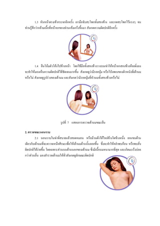 1.3 หันหนาตรงเขากระจกอีกครั้ง เอามือจับสะโพกทั้งสองขาง  และกดสะโพกไวแรงๆ จน
ทานรูสกวากลามเนื้อที่หนาอกของทานแข็งเกร็งขึ้นมา สังเกตความผิดปกติอีกครั้ง
        ึ




        1.4 ยืนโนมตัวโคงไปขางหนา โดยใชมอทั้งสองขางวางบนเขาใหหนาอกสองขางหอยดิ่งลง 
                                                ื
จะทําใหมองเห็นความผิดปกติไดชดเจนมากขึ้น สังเกตดูวามีรอยบุม หรือโปงพองของผิวหนังที่เตานม
                                 ั
หรือไม สังเกตดูรูปรางของเตานม และสังเกตวามีรอยบุมที่หัวนมทั้งสองขางหรือไม 




                             รูปที่ 7 แสดงการตรวจเตานมขณะยืน

2. ตรวจขณะนอนราบ
         2.1 นอนราบในทาที่สบายแลวสอดหมอน หรือมวนผาใตไหลขางใดขางหนึ่ง ยกแขนดาน
เดียวกับเตานมที่จะตรวจเหนือศีรษะเพื่อใหเตานมดานนันลอยขึ้น ซึ่งจะทําใหคลําพบกอน หรือพบสิ่ง
                                                     ้
ผิดปกติไดงายขึ้น โดยเฉพาะสวนบนดานนอกของเตานม ซึ่งมีเนื้อนมหนามากที่สุด และเกิดมะเร็งบอย
กวาสวนอื่น มองสํารวจเตานมใหทวสังเกตดูลักษณะผิดปกติ
                                 ั่
 