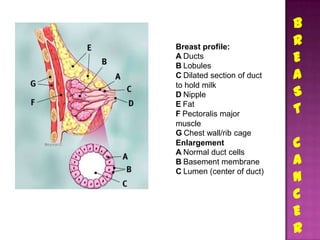 B
Breast profile:
                            R
A Ducts
B Lobules
                            E
C Dilated section of duct   A
to hold milk
D Nipple                    S
E Fat
F Pectoralis major          T
muscle
G Chest wall/rib cage
Enlargement                 C
A Normal duct cells
B Basement membrane         A
                            N
C Lumen (center of duct)


                            C
                            E
                            R
 