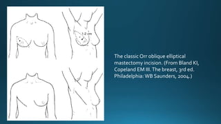 Orr Incision Breast Cancer by dr Isa Basuki | PPTX