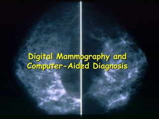 1
Digital Mammography andDigital Mammography and
Computer-Aided DiagnosisComputer-Aided Diagnosis
 