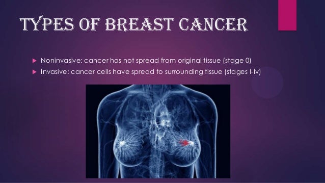 breast cancer powerpoint