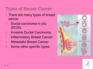 Types of Breast Cancer
5
 There are many types of breast
cancer
1. Ductal carcinoma in citu
(DCIS)
2. Invasive Ductal Carcinoma.
3. Inflammatory Breast Cancer
4. Metastatic Breast Cancer
5. Some other specific types.
 