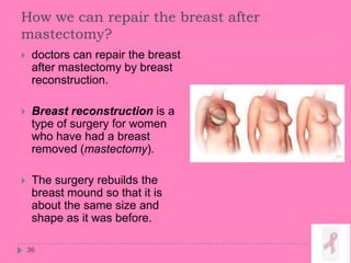 How we can repair the breast after
mastectomy?
36
 doctors can repair the breast
after mastectomy by breast
reconstruction.
 Breast reconstruction is a
type of surgery for women
who have had a breast
removed (mastectomy).
 The surgery rebuilds the
breast mound so that it is
about the same size and
shape as it was before.
 