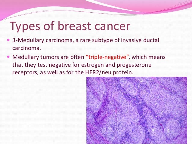 Breast cancer