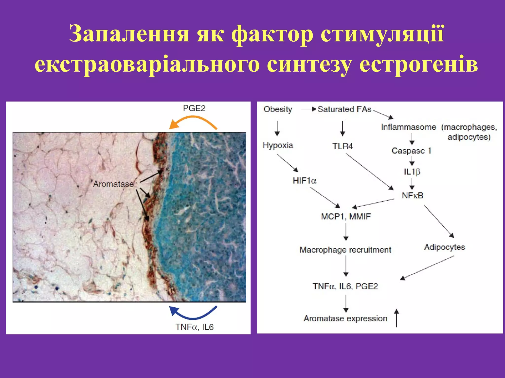 Breast cancer | PPT