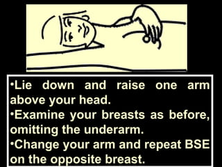 •Lie down and raise one arm
above your head.
•Examine your breasts as before,
omitting the underarm.
•Change your arm and repeat BSE
on the opposite breast.
 