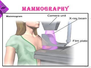 MAMMOGRAPHY
 