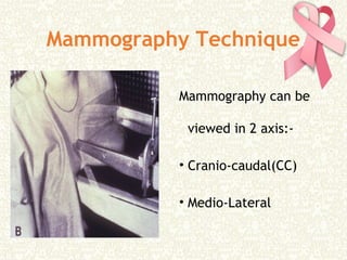 Mammography Technique
Mammography can be
viewed in 2 axis:-
• Cranio-caudal(CC)
• Medio-Lateral
 