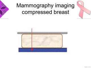 Mammography imaging
compressed breast
 