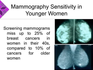 Mammography Sensitivity in
Younger Women
Screening mammograms
miss up to 25% of
breast cancers in
women in their 40s,
compared to 10% of
cancers for older
women
 