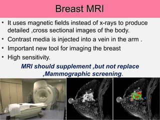 Breast MRIBreast MRI
• It uses magnetic fields instead of x-rays to produce
detailed ,cross sectional images of the body.
• Contrast media is injected into a vein in the arm .
• Important new tool for imaging the breast
• High sensitivity.
MRI should supplement ,but not replace
,Mammographic screening.
 