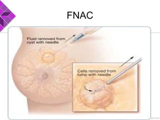 FNAC
 