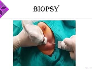 BIOPsY
 