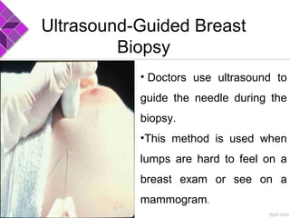 Ultrasound-Guided Breast
Biopsy
• Doctors use ultrasound to
guide the needle during the
biopsy.
•This method is used when
lumps are hard to feel on a
breast exam or see on a
mammogram.
 