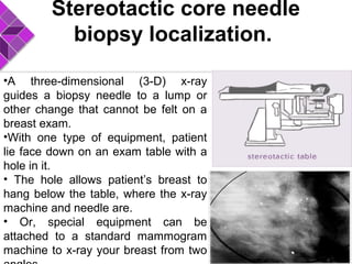 Stereotactic core needle
biopsy localization.
•A three-dimensional (3-D) x-ray
guides a biopsy needle to a lump or
other change that cannot be felt on a
breast exam.
•With one type of equipment, patient
lie face down on an exam table with a
hole in it.
• The hole allows patient’s breast to
hang below the table, where the x-ray
machine and needle are.
• Or, special equipment can be
attached to a standard mammogram
machine to x-ray your breast from two
 
