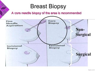Breast Biopsy
A core needle biopsy of the area is recommendedA core needle biopsy of the area is recommended
Non-
Surgical
Surgical
 