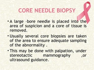 CORE NEEDLE BIOPSY
• A large –bore needle is placed into the
area of suspicion and a core of tissue is
removed.
• Usually several core biopsies are taken
of the area to ensure adequate sampling
of the abnormality .
• This may be done with palpation, under
stereotactic mammography ,or
ultrasound guidance.
 