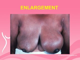 ENLARGEMENT
 