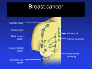 Breast cancer
Spread to lymph nodes
Supraclavicular
Subclavicular
Distal (upper)
axillary
Central (middle)
axillary
Proximal (lower)
axillary
Mediastinal
Internal mammary
Interpectoral
(Rotter’s)
 