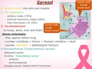 Spread
1- Direct (Local) into skin and muscle
2- Via lymphatics
• Axillary nodes (75%)
• Internal mammary nodes (20%)
• Post intercostal L.N. (5%)
3- Via bloodstream
to lungs, bone, liver and brain
Bones metastasis:
 -May appear before lung
 -Lumbar vertebrae > femur > thoracic vertebra > skull
 -usually osteolytic → pathological fracture
4-Transperitoneal (Transcoelomic) spread:-
 Malignant ascitis
 Ovaries: Krukenberg's tumor
 bilateral
 premenepausal
 Douglas pouch: Rectal shelf of Plummer
Cancer cells
invade
lymph duct
Cancer cells
invade
blood vessel
 