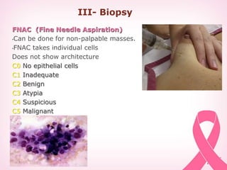 III- Biopsy
FNAC (Fine Needle Aspiration)
•Can be done for non-palpable masses.
•FNAC takes individual cells
Does not show architecture
C0 No epithelial cells
C1 Inadequate
C2 Benign
C3 Atypia
C4 Suspicious
C5 Malignant
 