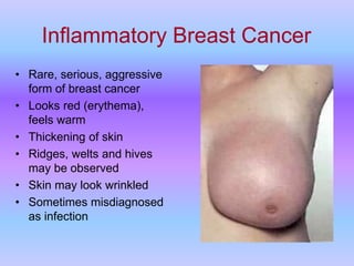 Breast cancer  سرطان الثدي