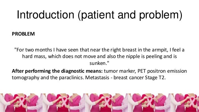 Breast cancer case study answers picture