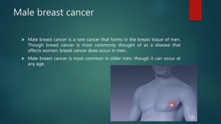 Male breast cancer
 Male breast cancer is a rare cancer that forms in the breast tissue of men.
Though breast cancer is most commonly thought of as a disease that
affects women, breast cancer does occur in men.
 Male breast cancer is most common in older men, though it can occur at
any age.
 