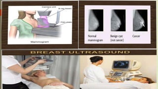 Breast cancer ppt med surg