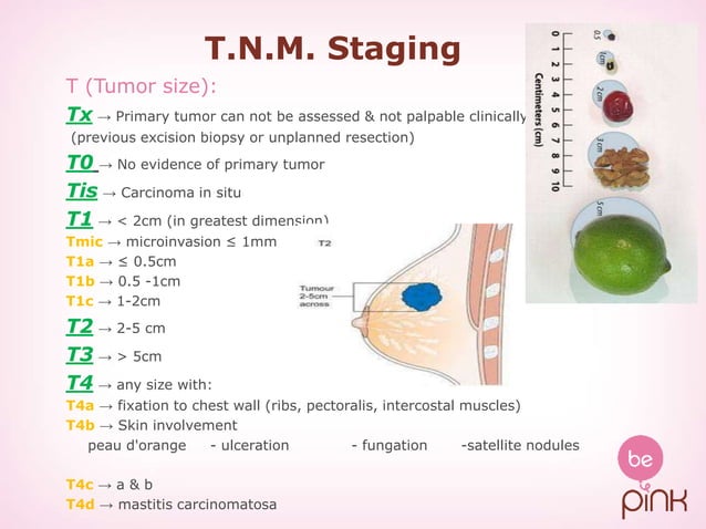 Breast Cancer PPT breast-cancer-ppt