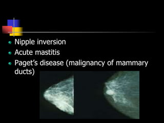 Nipple inversion
Acute mastitis
Paget’s disease (malignancy of mammary
ducts)
 