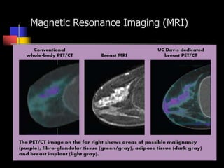 Magnetic Resonance Imaging (MRI)
 