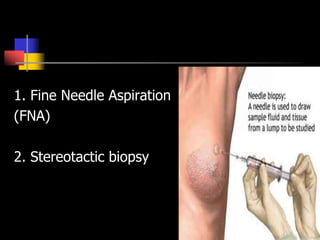 1. Fine Needle Aspiration
(FNA)
2. Stereotactic biopsy
 