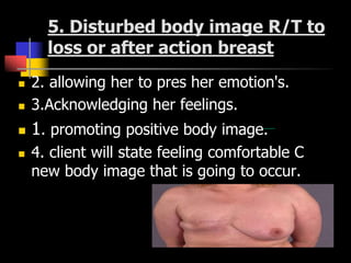 5. Disturbed body image R/T to
loss or after action breast
 2. allowing her to pres her emotion's.
 3.Acknowledging her feelings.
 1. promoting positive body image.
 4. client will state feeling comfortable C
new body image that is going to occur.
 