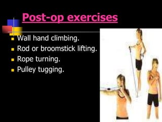Post-op exercises
 Wall hand climbing.
 Rod or broomstick lifting.
 Rope turning.
 Pulley tugging.
 