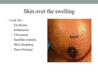 BREAST CANCER.pptx