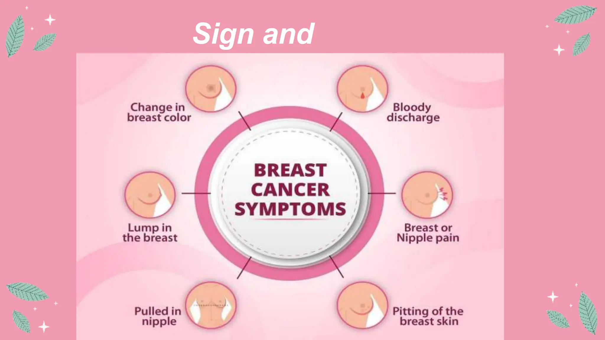 Breast Cancer seminar about breast cancer | PPTX