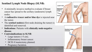 Breast Cancer: Staging, Diagnosis, Prognosis and Treatment Guidelines ...