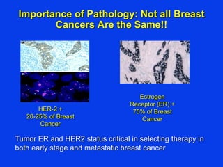 Importance of Pathology: Not all Breast
Cancers Are the Same!!
Estrogen
Receptor (ER) +
75% of Breast
Cancer
HER-2 +
20-25% of Breast
Cancer
Tumor ER and HER2 status critical in selecting therapy in
both early stage and metastatic breast cancer
 