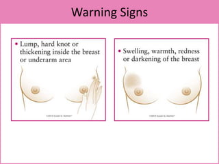 Warning Signs
 