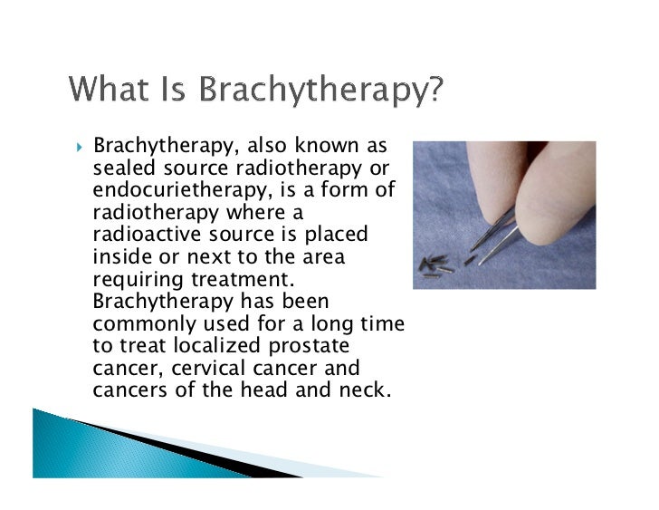 Breast cancer brachytherapy
