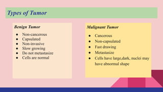 Malignant Tumor
● Cancerous
● Non-capsulated
● Fast drawing
● Metastasize
● Cells have large,dark, nuclei may
have abnormal shape
Benign Tumor
● Non-cancerous
● Capsulated
● Non-invasive
● Slow growing
● Do not metastasize
● Cells are normal
Types of Tumor
 
