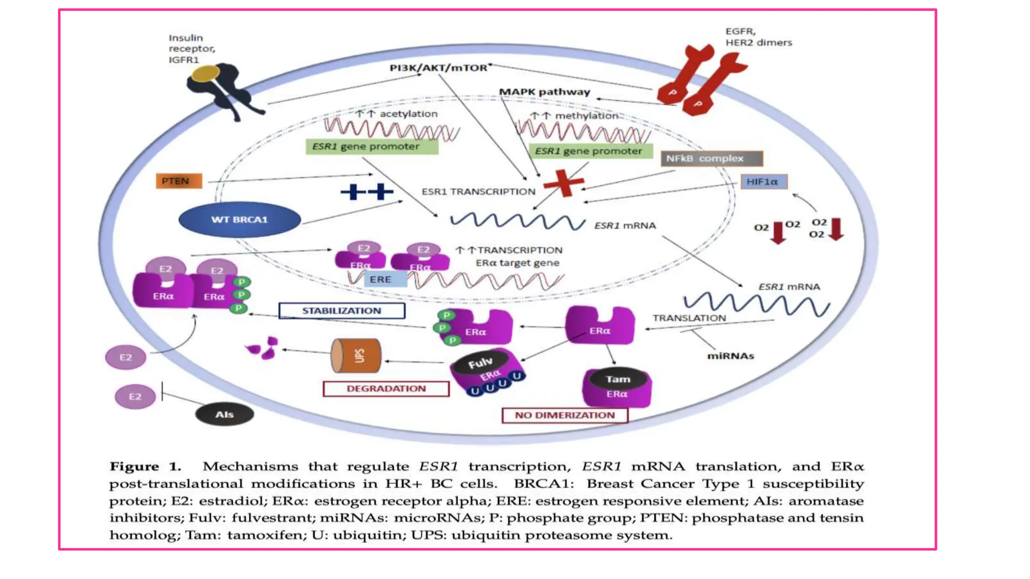 Breast cancer :Receptor (ER/PR/HER2 NEU) Discordance.pptx