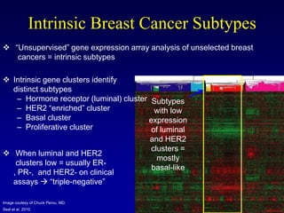 Intrinsic Breast Cancer Subtypes
 “Unsupervised” gene expression array analysis of unselected breast
   cancers = intrinsic subtypes

 Intrinsic gene clusters identify
  distinct subtypes
   – Hormone receptor (luminal) cluster Subtypes
   – HER2 “enriched” cluster             with low
   – Basal cluster                     expression
   – Proliferative cluster              of luminal          ER-negative
                                       and HER2              subtypes
                                       clusters =
 When luminal and HER2
                                         mostly
   clusters low = usually ER-
                                       basal-like
  , PR-, and HER2- on clinical
  assays  “triple-negative”

Image coutesy of Chuck Perou, MD.
Seal et al, 2010.
 